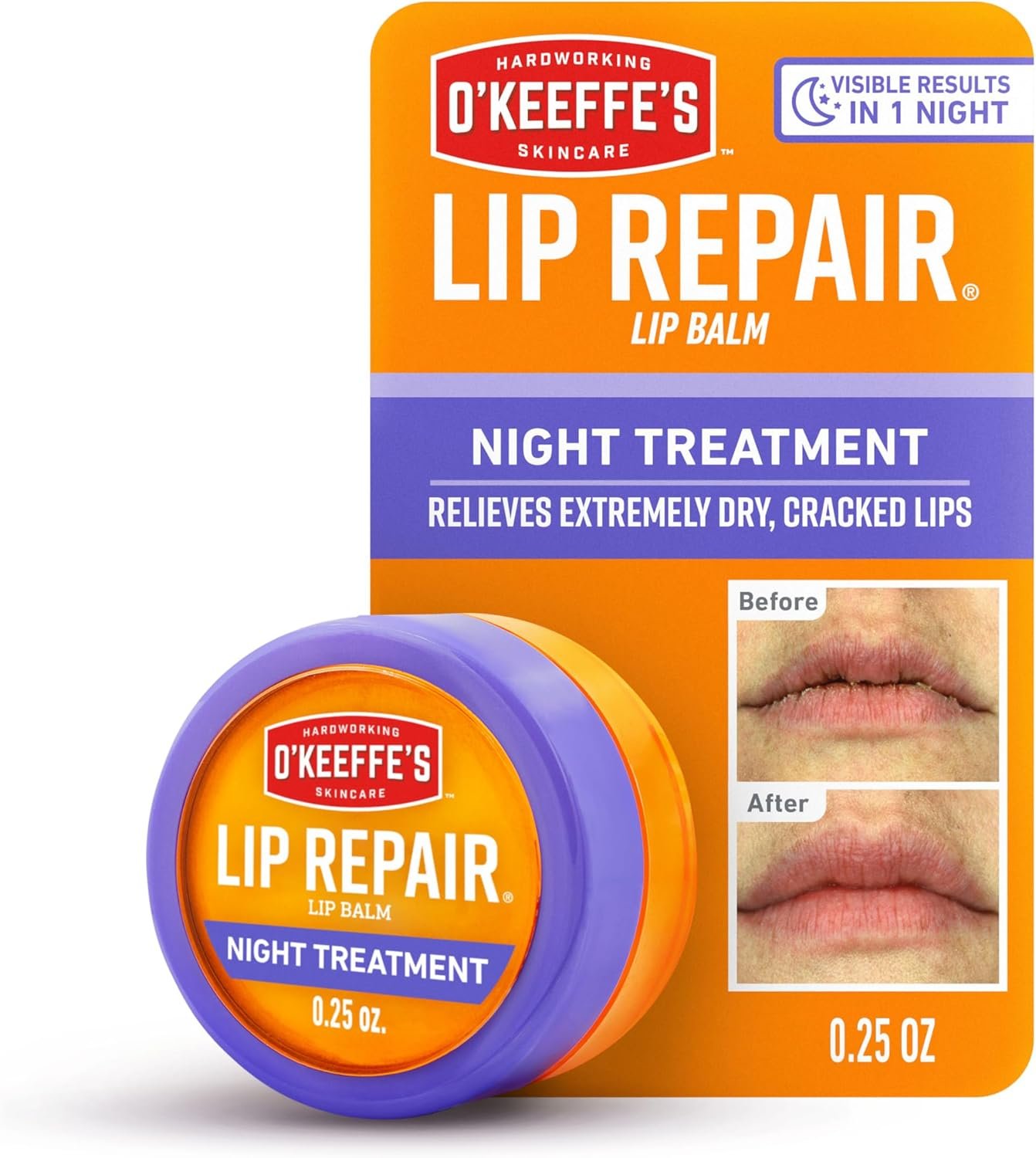 O’Keeffe’s Lip Repair Night Treatment Lip Balm for Dry, Cracked Lips – 0.25 Ounce Jar (1 Pack) – Moisturizer Extremely Cracked, Dry Lips